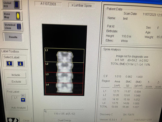 HOLOGIC Discovery QDR  series 2012 DEXA Bone Densitometer