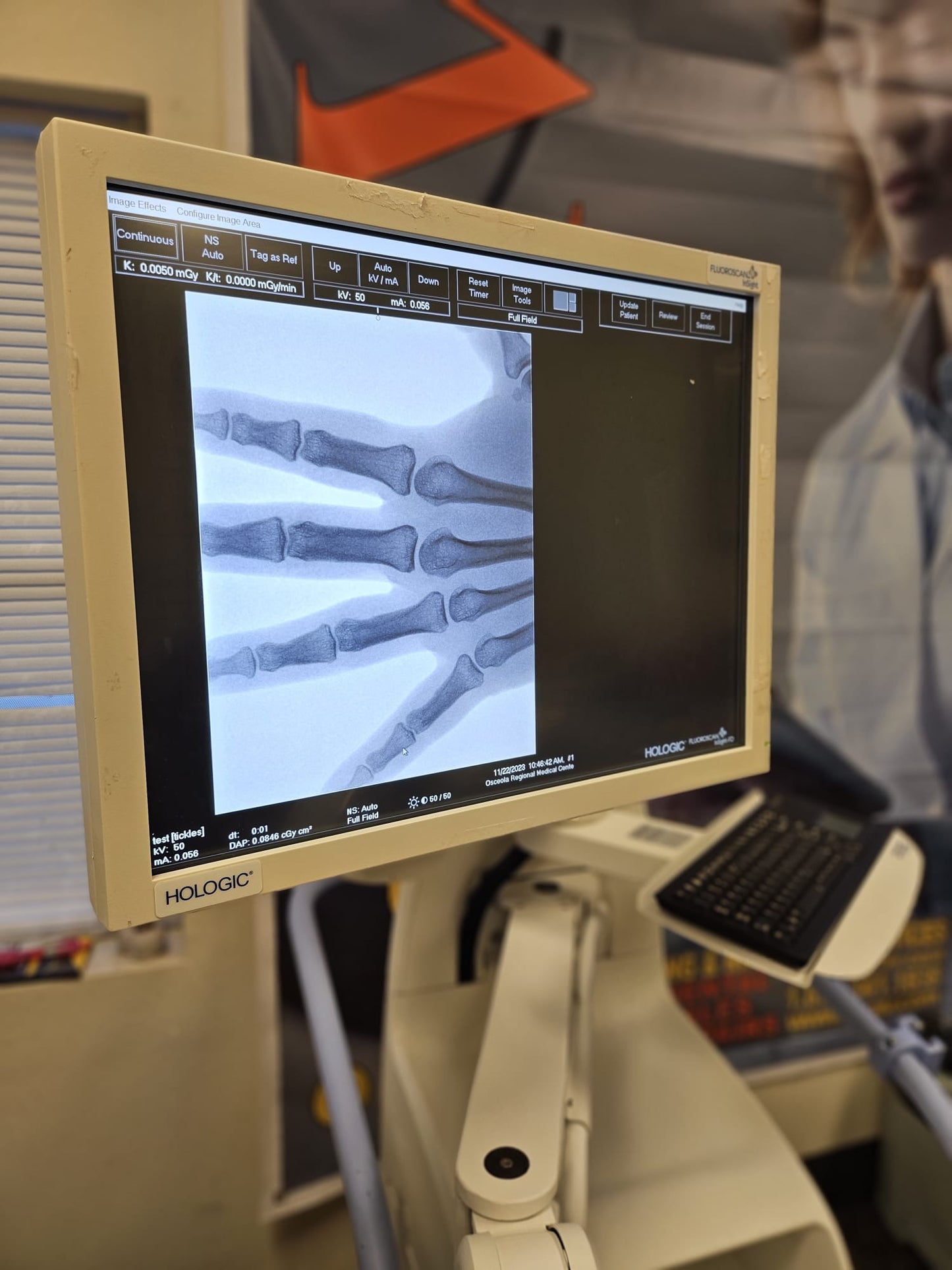 Fluoroscan Insight FD Mini C-Arm