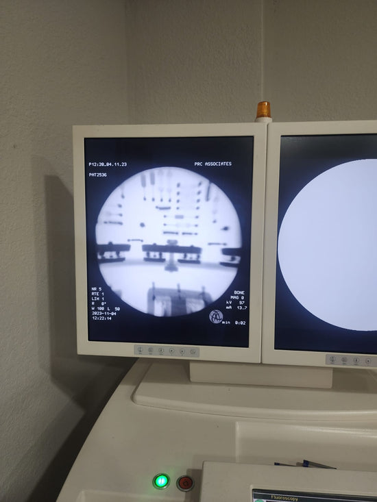 Copy of ZIEHM Vista C-arm with double monitor screen