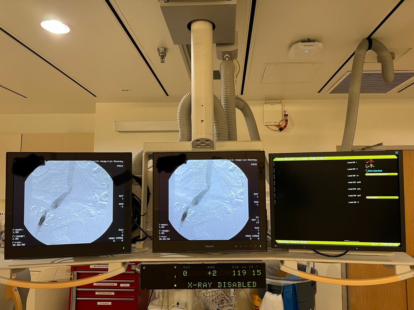 Philips Integris Allura Cath Lab