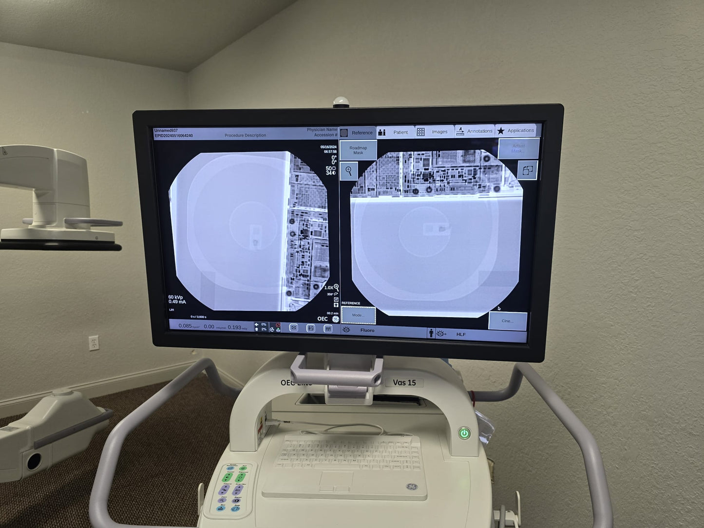 GE OEC ELITE CFD 31cm Flat Detector Super C-Arm - VAS 15 Software