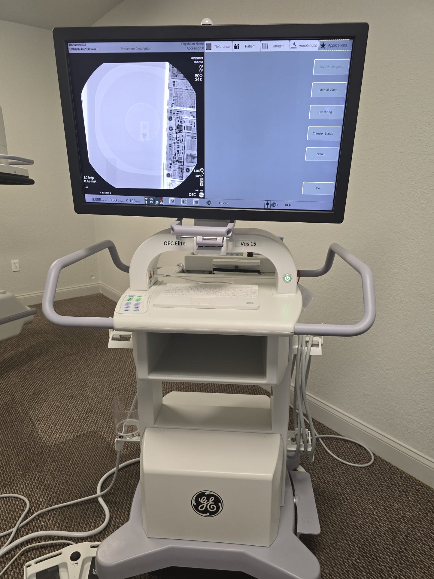 GE OEC ELITE CFD 31cm Flat Detector Super C-Arm - VAS 15 Software