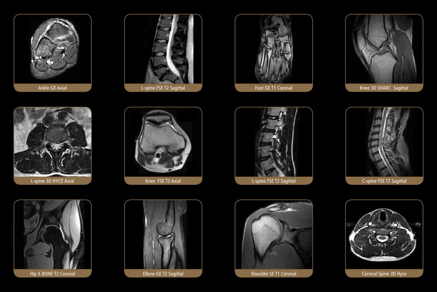 ESAOTE S-SCAN Open Dedicate MRI - 2010 WITH CAGE