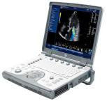 GE Vivid e Portable Ultrasound System