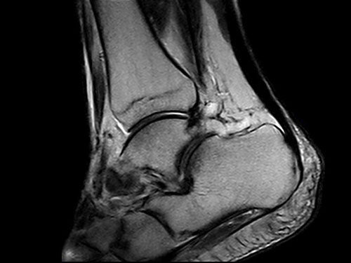 ESAOTE O-SCAN eXP  2016 - Dedicate MRI for Extremities with Cage