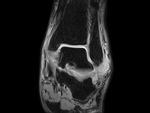 ESAOTE O-SCAN eXP  2016 - Dedicate MRI for Extremities with Cage