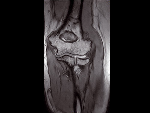 ESAOTE O-SCAN eXP  2016 - Dedicate MRI for Extremities with Cage