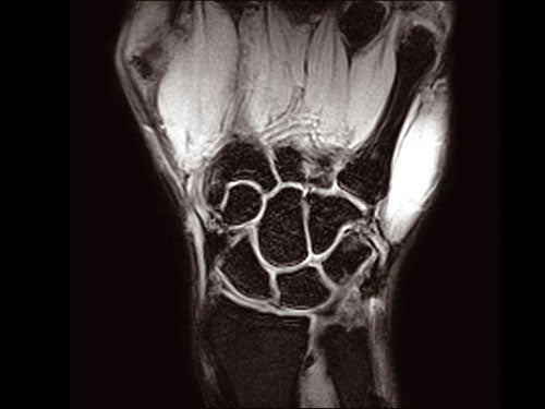 ESAOTE O-SCAN eXP  2016 - Dedicate MRI for Extremities with Cage
